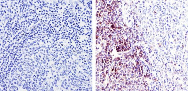 TRAC Antibody in Immunohistochemistry (Paraffin) (IHC (P))