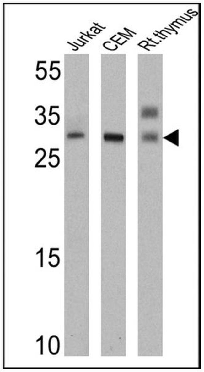 TCR V alpha 12.1 Antibody in Western Blot (WB)