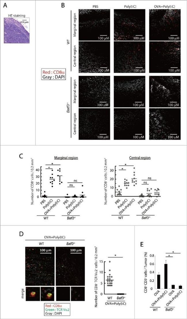 TCR V alpha 2 Antibody in Immunocytochemistry (ICC/IF)