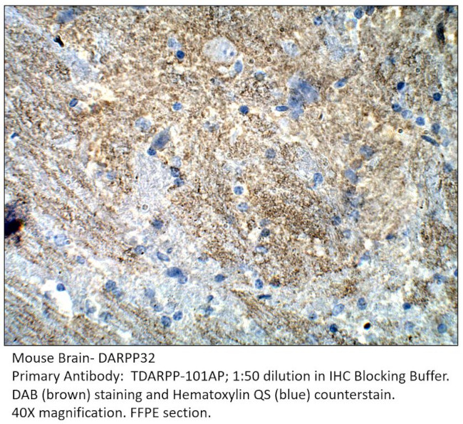 DARPP32 Antibody in Immunohistochemistry (IHC)