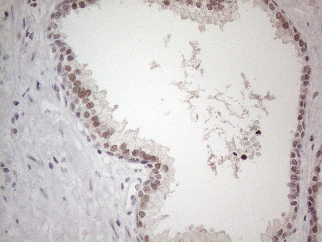 TDG Antibody in Immunohistochemistry (Paraffin) (IHC (P))