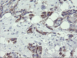 TDO2 Antibody in Immunohistochemistry (Paraffin) (IHC (P))