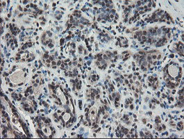 TDO2 Antibody in Immunohistochemistry (Paraffin) (IHC (P))