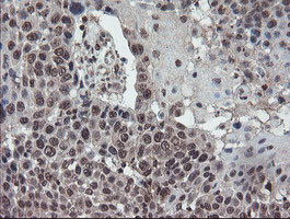 TDO2 Antibody in Immunohistochemistry (Paraffin) (IHC (P))