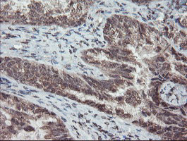 TDO2 Antibody in Immunohistochemistry (Paraffin) (IHC (P))