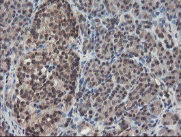 TDO2 Antibody in Immunohistochemistry (Paraffin) (IHC (P))