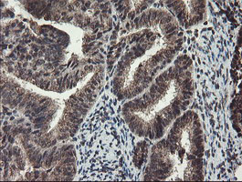 TDO2 Antibody in Immunohistochemistry (Paraffin) (IHC (P))