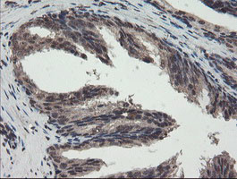 TDO2 Antibody in Immunohistochemistry (Paraffin) (IHC (P))