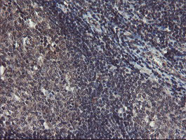 TDO2 Antibody in Immunohistochemistry (Paraffin) (IHC (P))