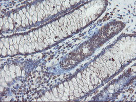 TDO2 Antibody in Immunohistochemistry (Paraffin) (IHC (P))