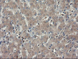 TDO2 Antibody in Immunohistochemistry (Paraffin) (IHC (P))