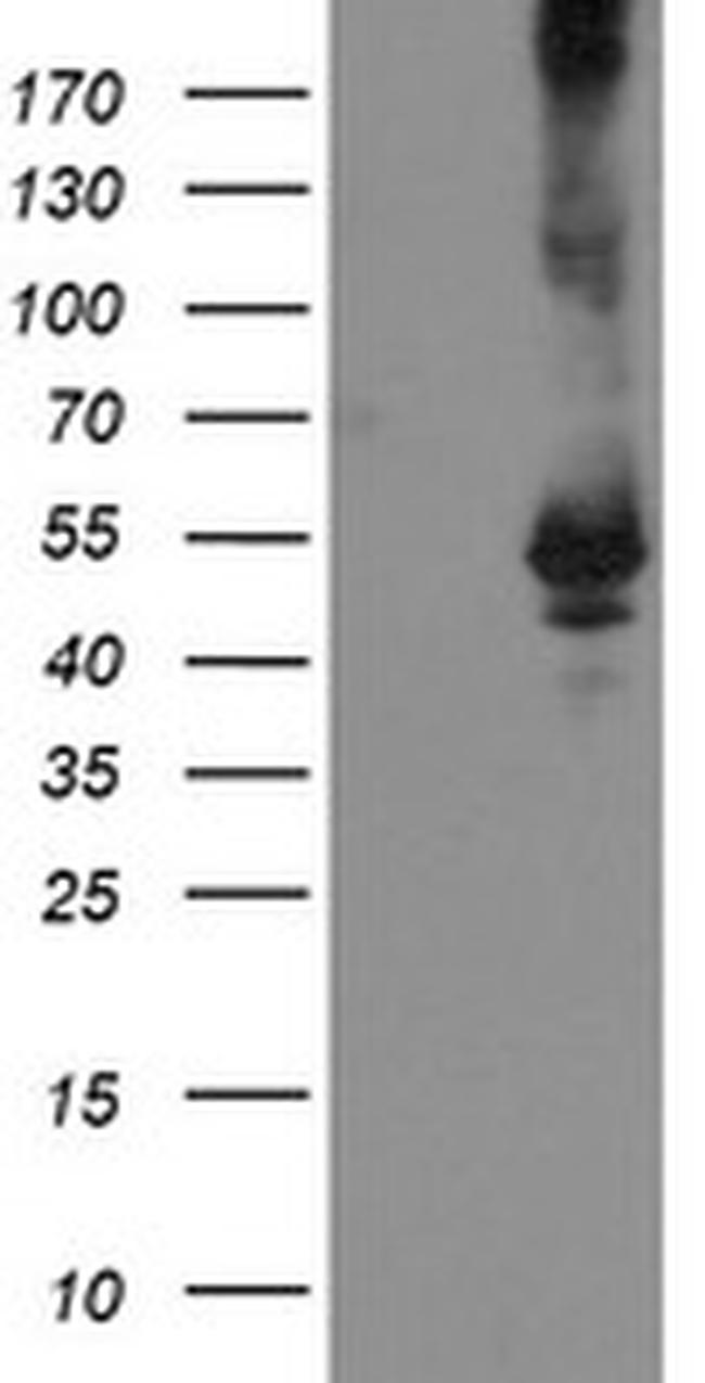 TDO2 Antibody in Western Blot (WB)