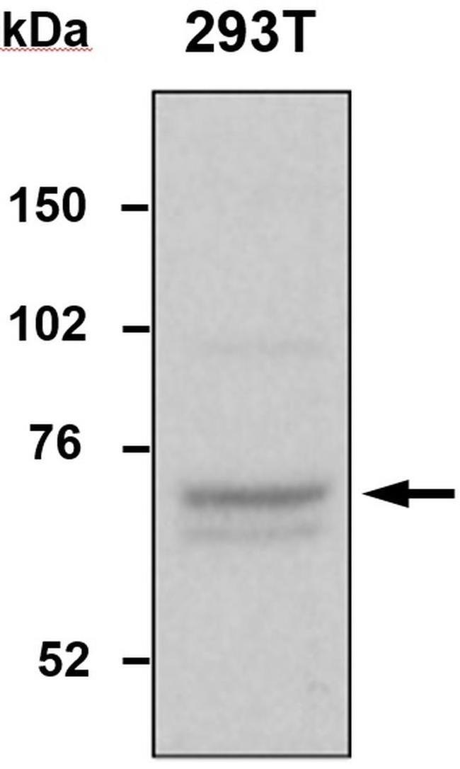 TDP1 Antibody in Western Blot (WB)