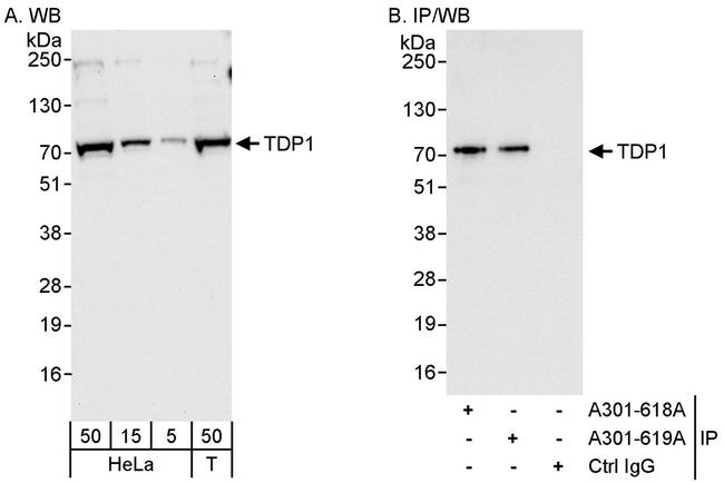 TDP1 Antibody in Western Blot (WB)