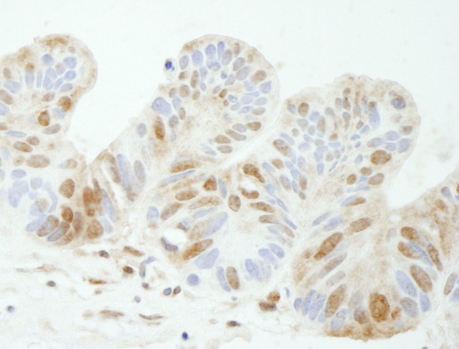 TDP1 Antibody in Immunohistochemistry (IHC)