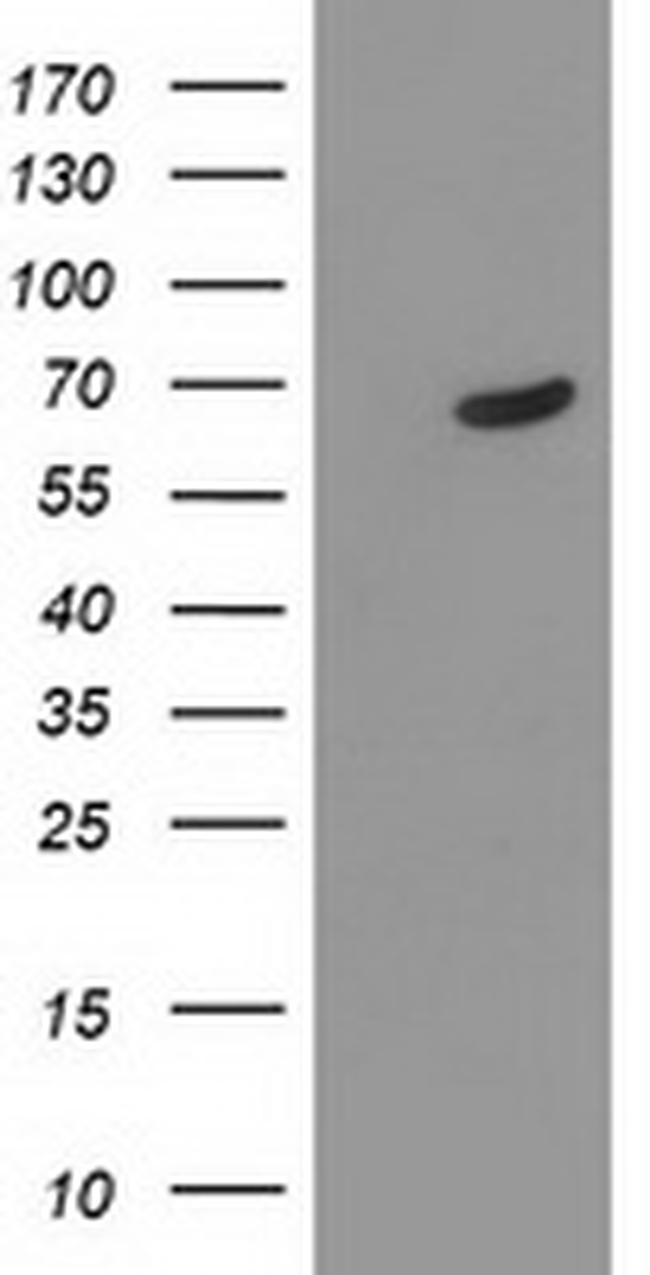 TDP1 Antibody in Western Blot (WB)