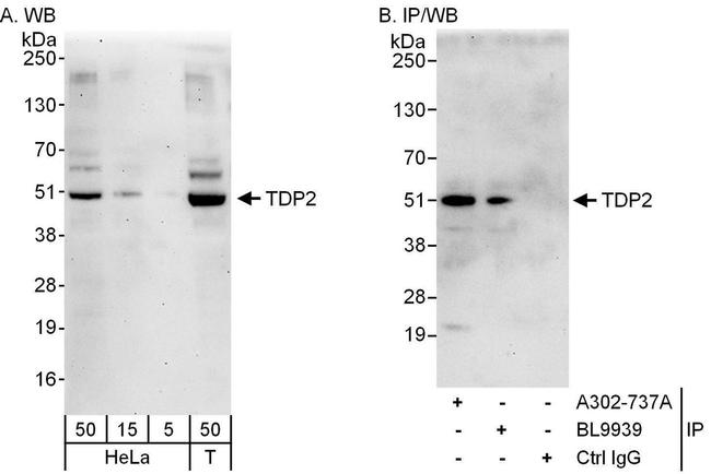 TDP2 Antibody in Western Blot (WB)