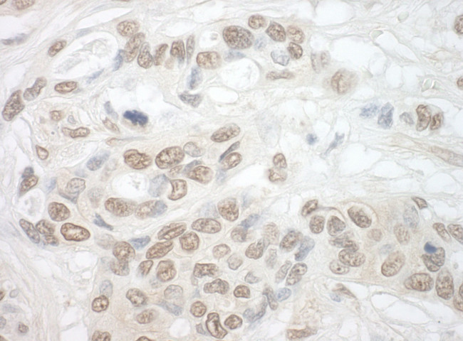 TDRD3 Antibody in Immunohistochemistry (IHC)