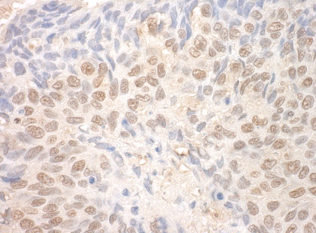 TDRD3 Antibody in Immunohistochemistry (IHC)