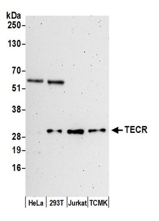 TECR Antibody in Western Blot (WB)