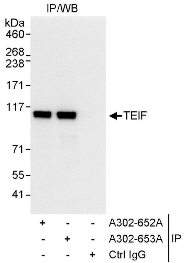 TEIF Antibody in Immunoprecipitation (IP)