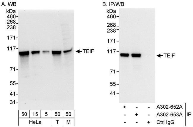 TEIF Antibody in Western Blot (WB)