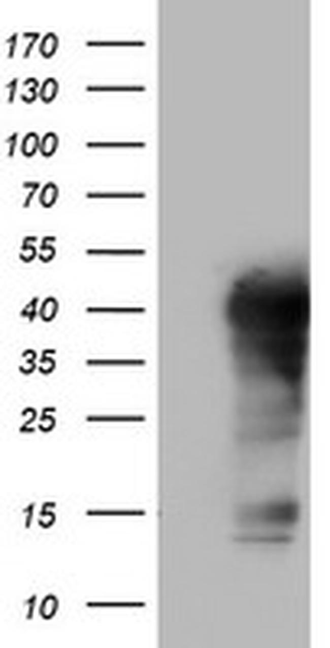 TET1 Antibody in Western Blot (WB)