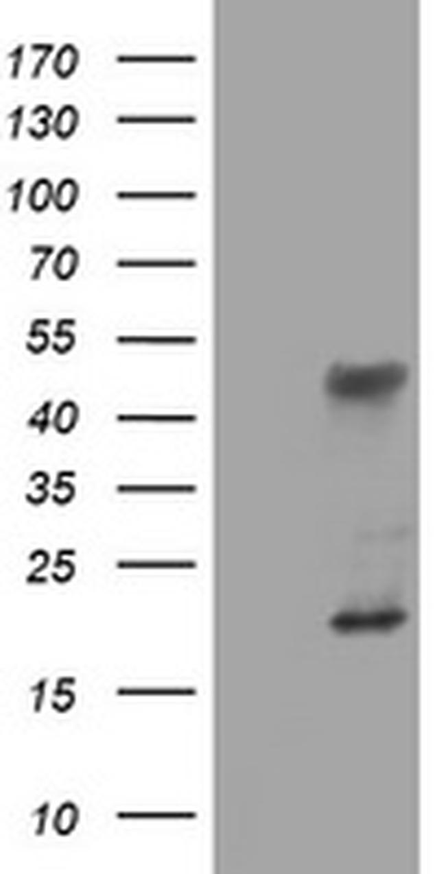 TET1 Antibody in Western Blot (WB)