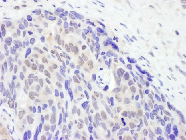 TET2 Antibody in Immunohistochemistry (IHC)