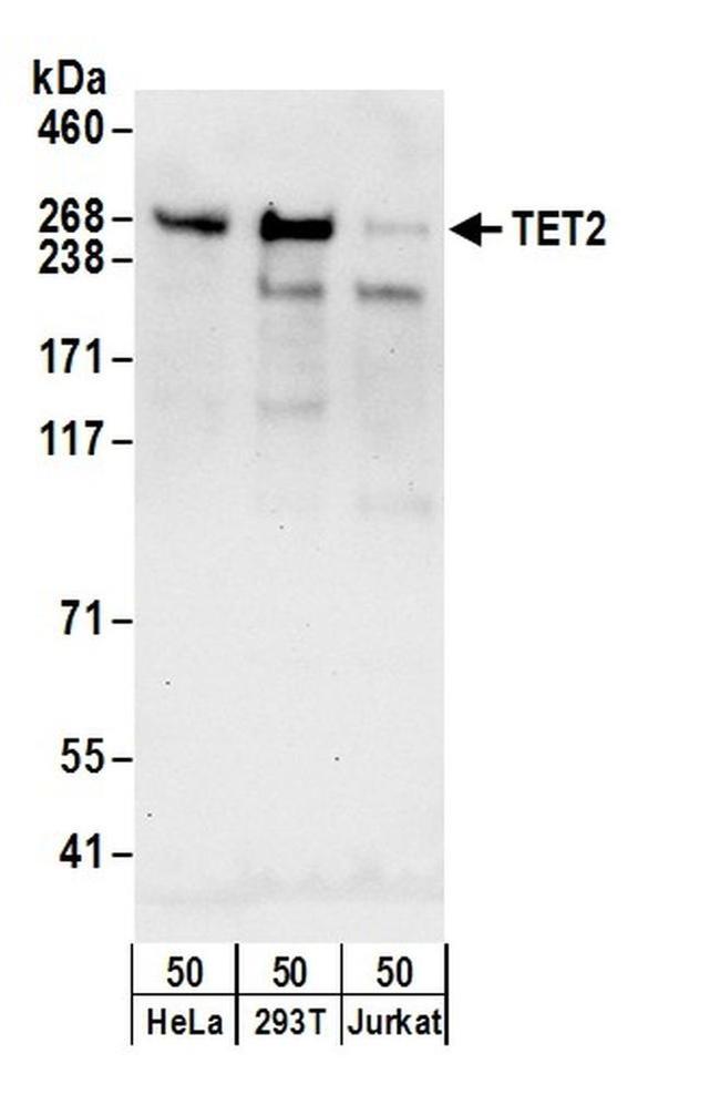 TET2 Antibody in Western Blot (WB)