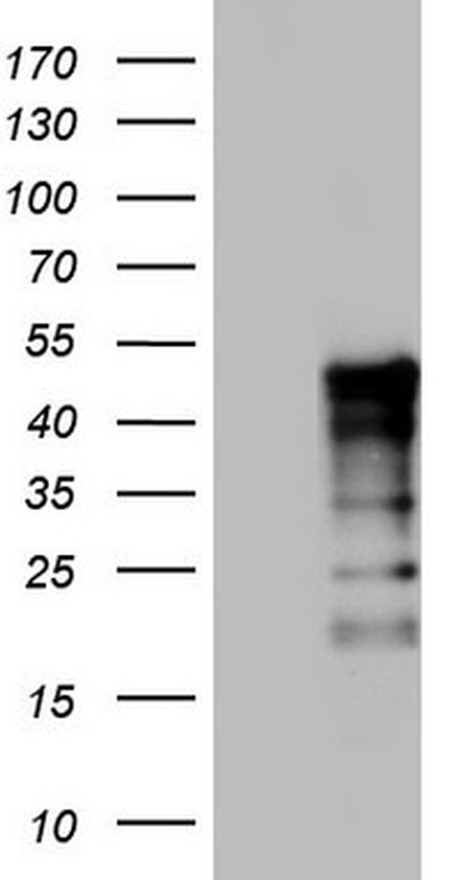 TET3 Antibody in Western Blot (WB)