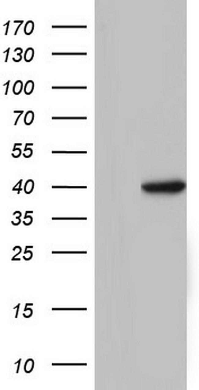 TFB1M Antibody in Western Blot (WB)