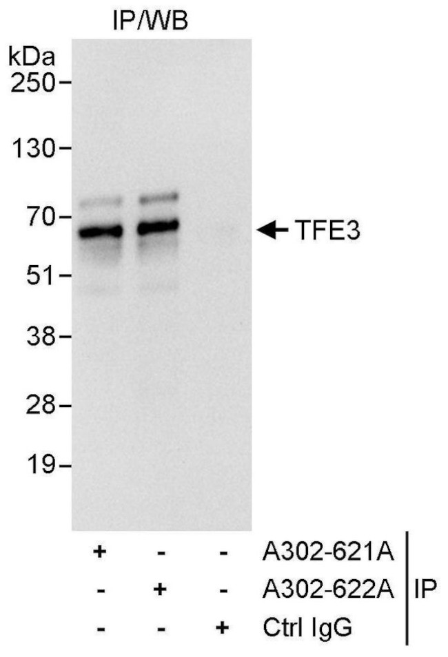 TFE3 Antibody in Immunoprecipitation (IP)