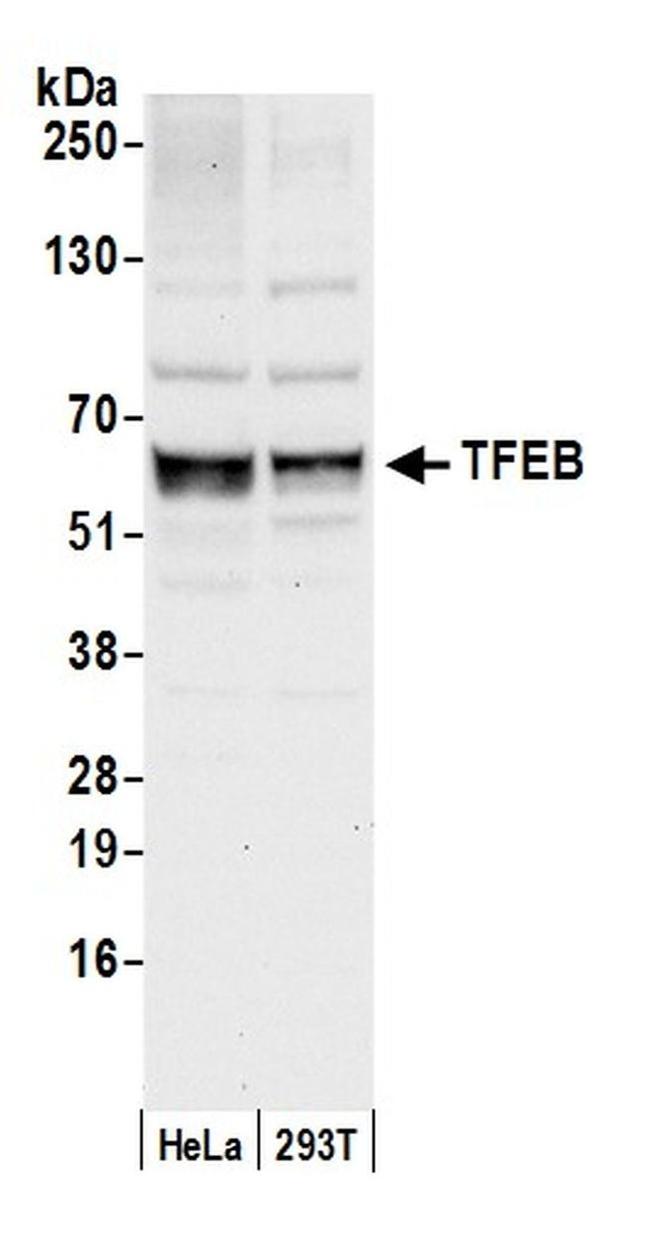 TFEB Antibody in Western Blot (WB)