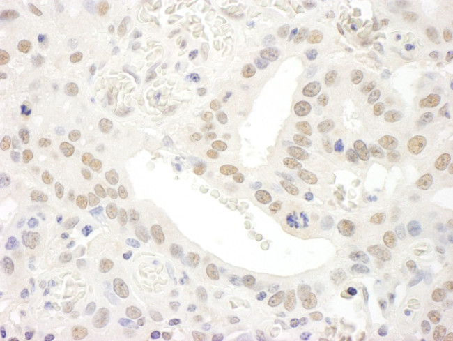 TFIIS Antibody in Immunohistochemistry (IHC)