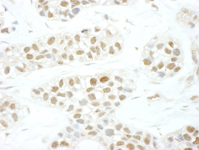 TFIIS Antibody in Immunohistochemistry (IHC)