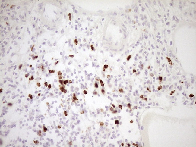 TFPI Antibody in Immunohistochemistry (Paraffin) (IHC (P))