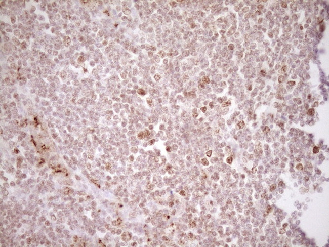 TFPI Antibody in Immunohistochemistry (Paraffin) (IHC (P))