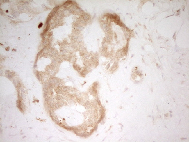 TFPI Antibody in Immunohistochemistry (Paraffin) (IHC (P))