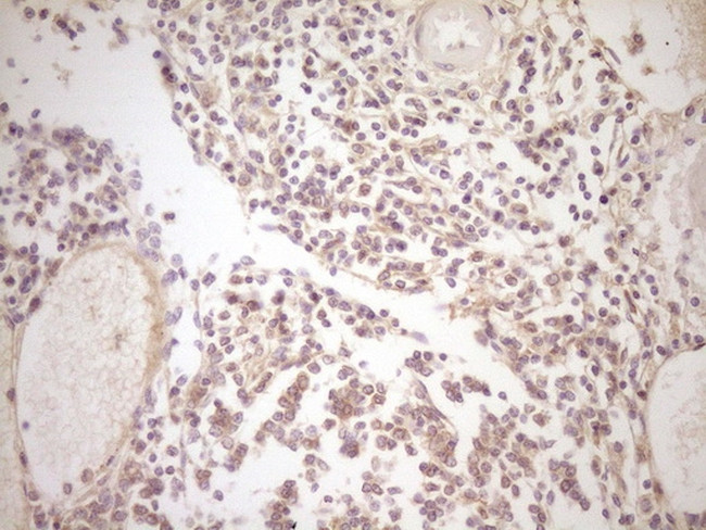 TFPI Antibody in Immunohistochemistry (Paraffin) (IHC (P))