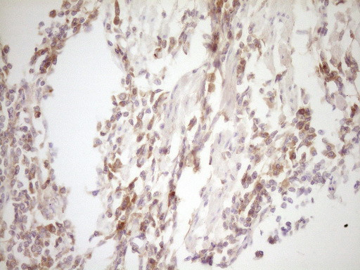 TFPI Antibody in Immunohistochemistry (Paraffin) (IHC (P))