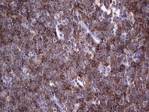 TFPI2 Antibody in Immunohistochemistry (Paraffin) (IHC (P))