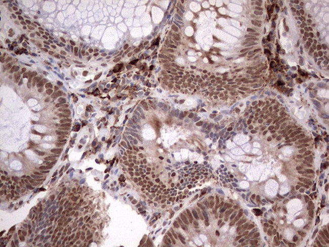 TFPI2 Antibody in Immunohistochemistry (Paraffin) (IHC (P))