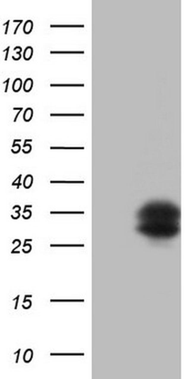 TFPI2 Antibody in Western Blot (WB)