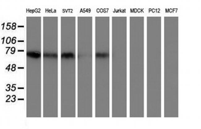 TFR2 Antibody in Western Blot (WB)