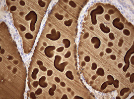 TG Antibody in Immunohistochemistry (Paraffin) (IHC (P))