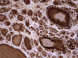 TG Antibody in Immunohistochemistry (Paraffin) (IHC (P))