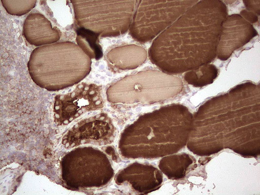 TG Antibody in Immunohistochemistry (Paraffin) (IHC (P))