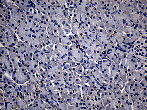 TG Antibody in Immunohistochemistry (Paraffin) (IHC (P))