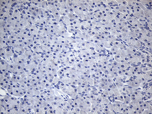 TG Antibody in Immunohistochemistry (Paraffin) (IHC (P))